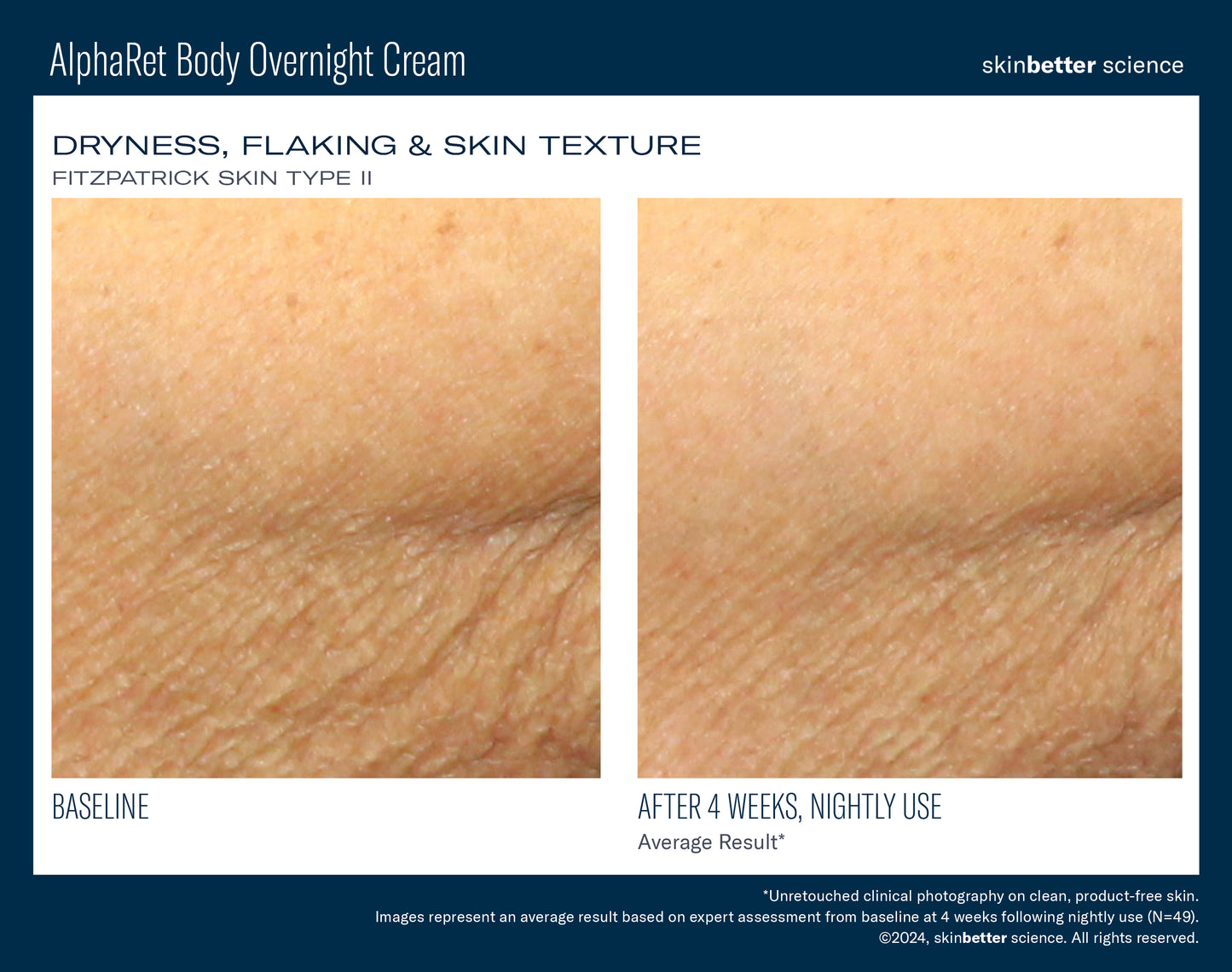 AlphaRet Overnight Body Cream