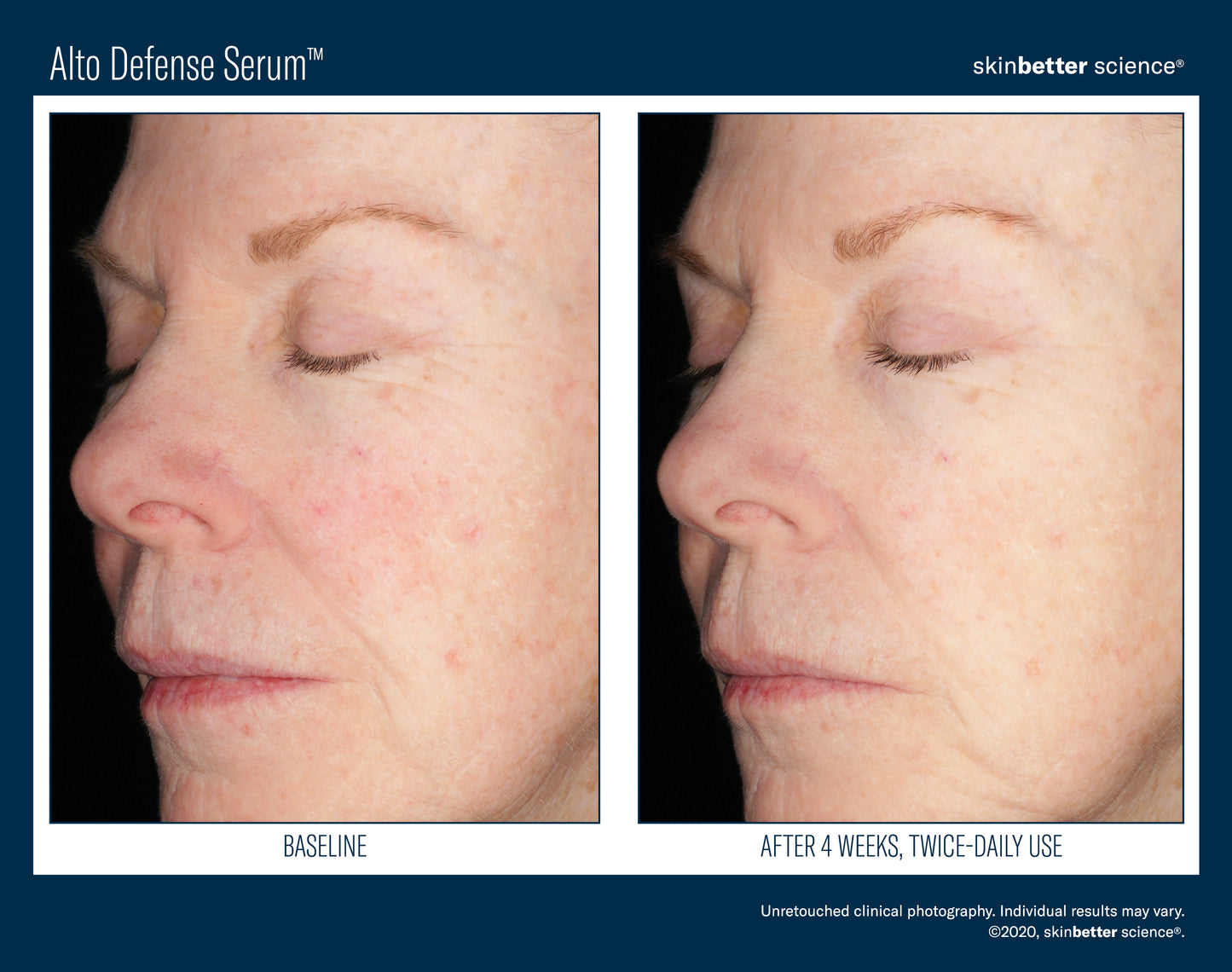 Alto Advanced Serum