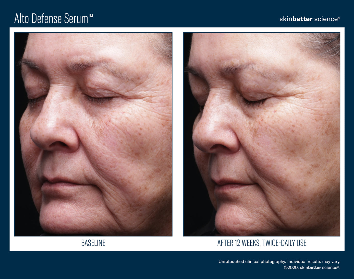 Alto Advanced Serum