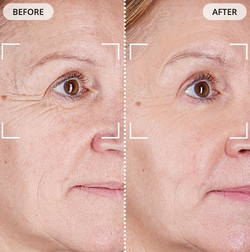 Currentbody LED Face Mask Series 2