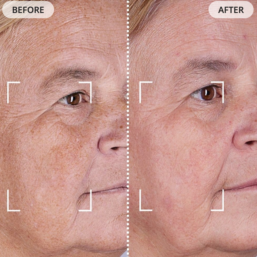 Currentbody LED Face Mask Series 2