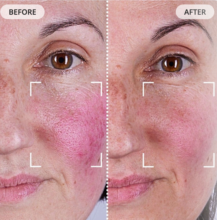 Currentbody LED Face Mask Series 2