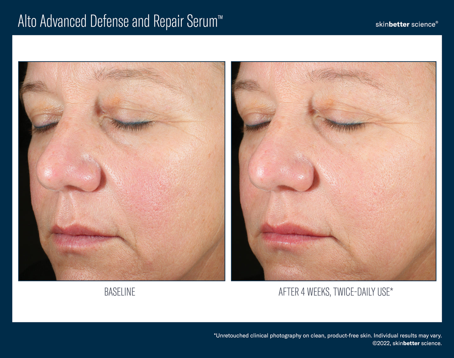 Alto Advanced Serum