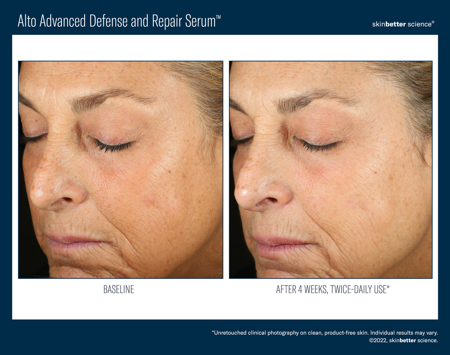 Alto Advanced Serum