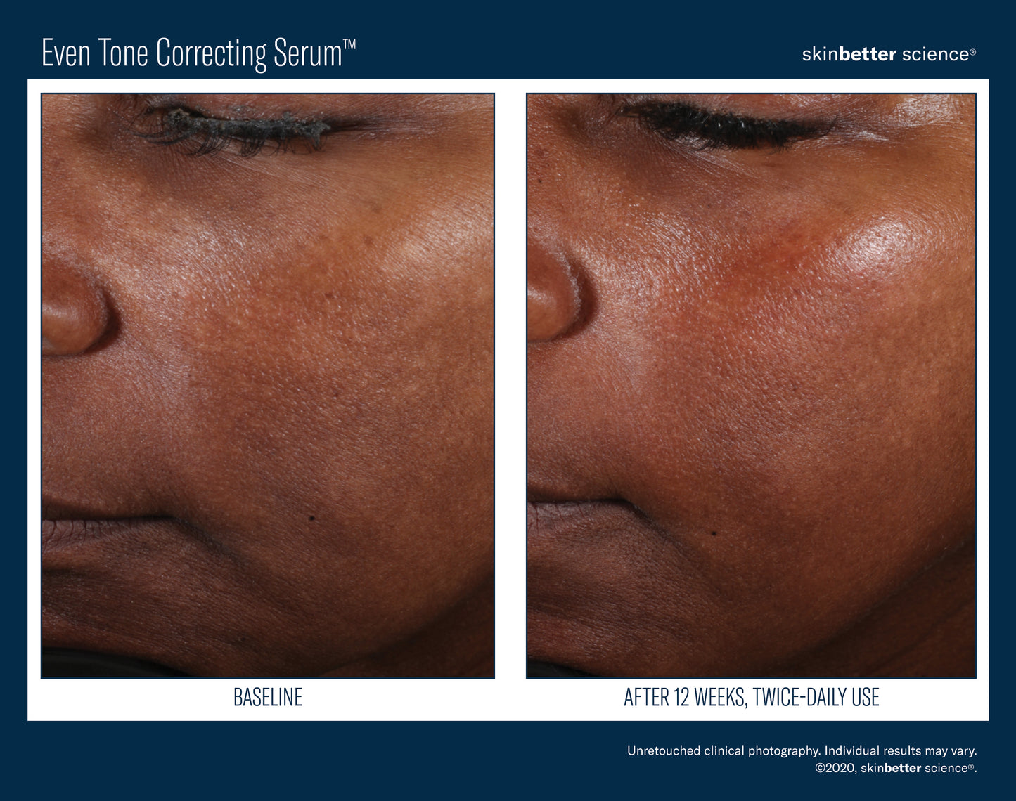 Even Tone Correcting Serum
