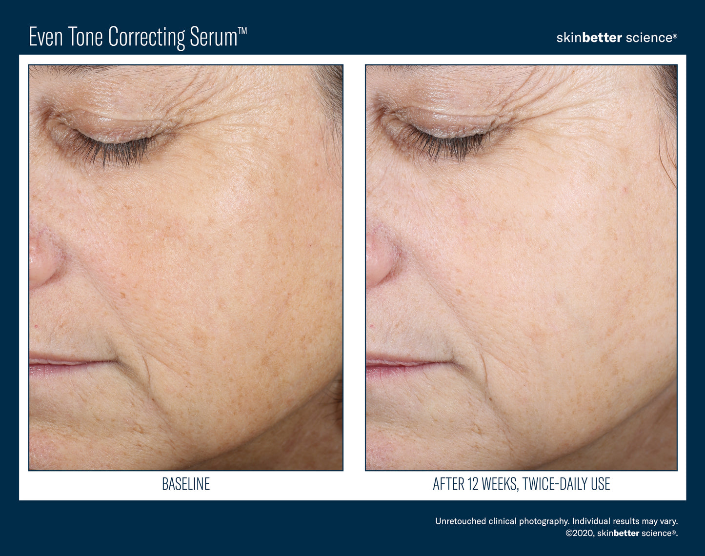Even Tone Correcting Serum