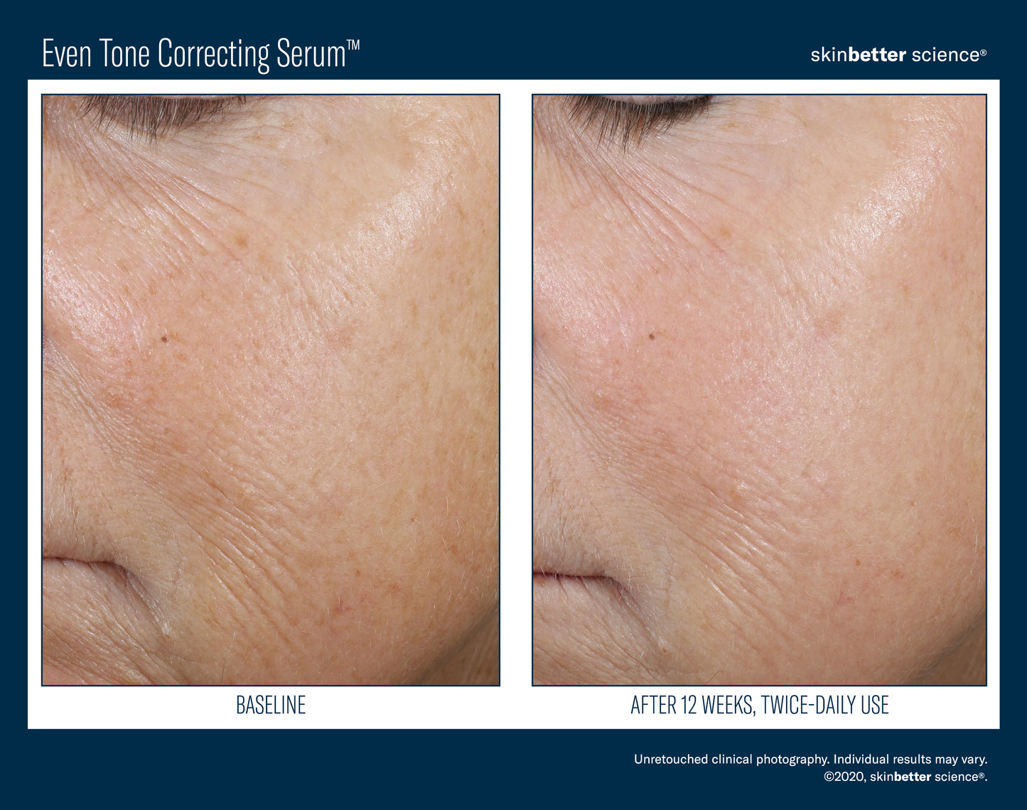 Even Tone Correcting Serum
