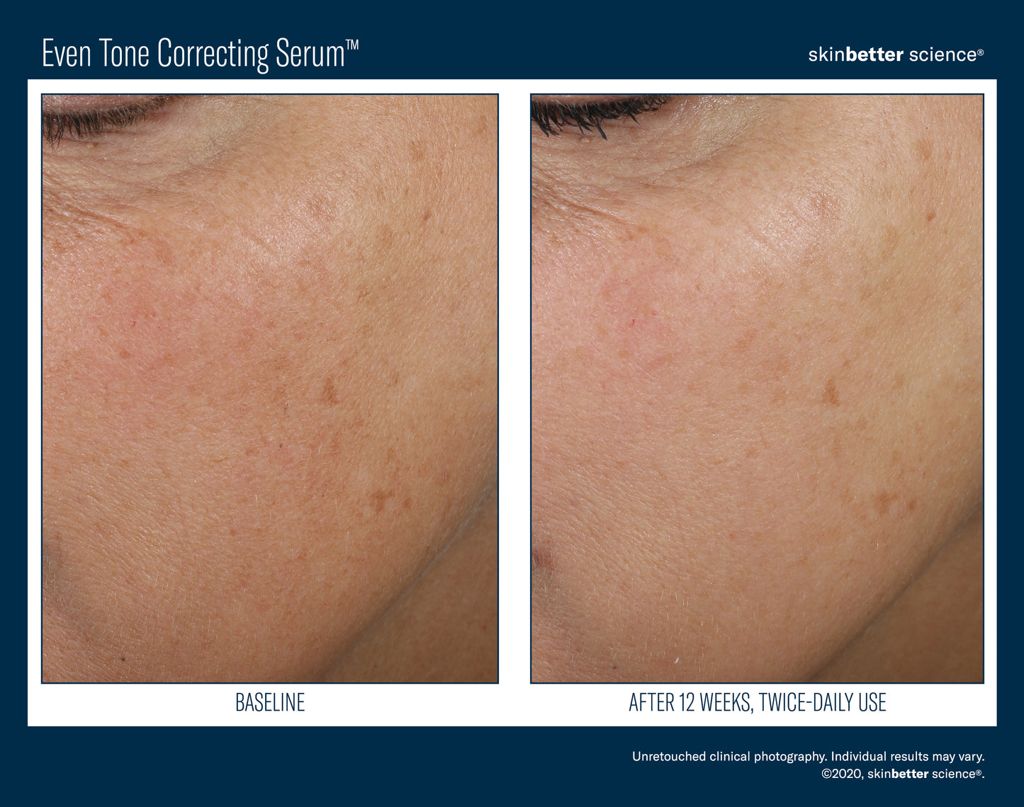 Even Tone Correcting Serum