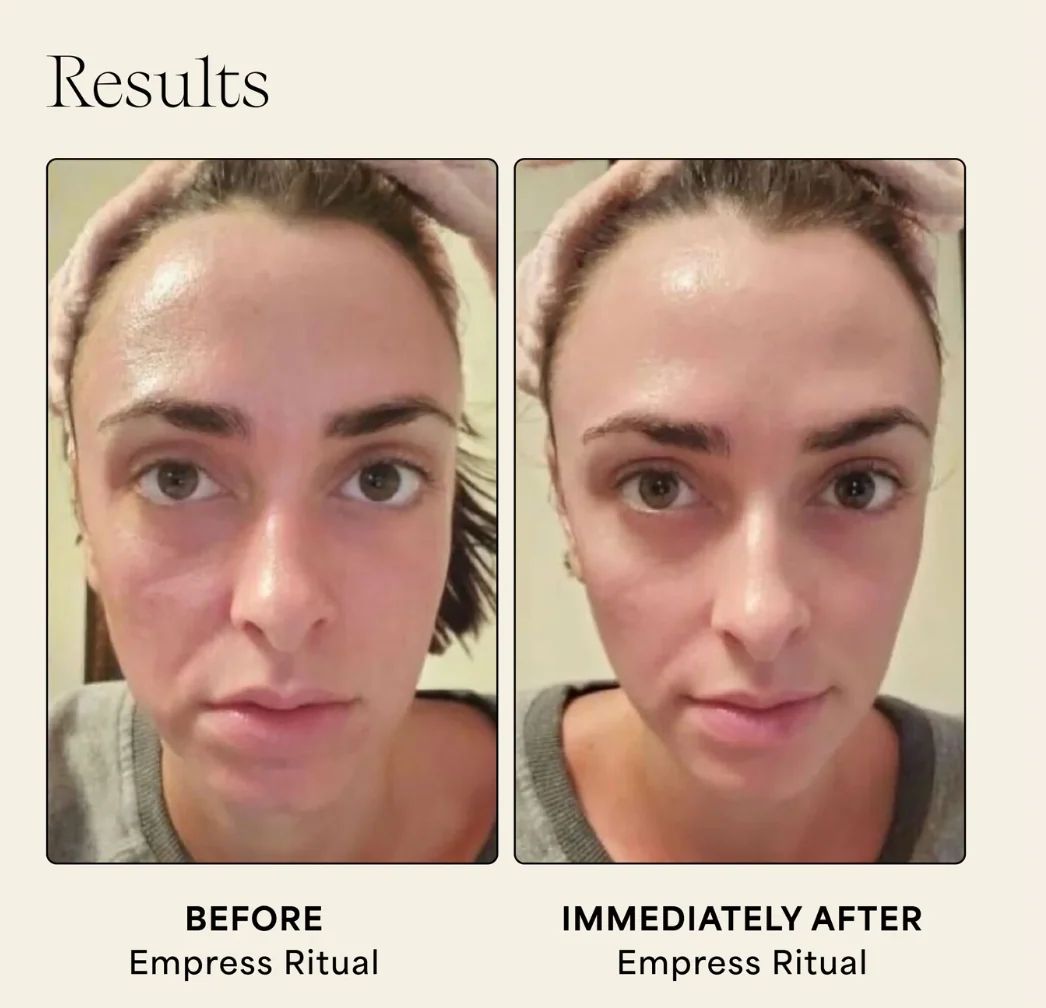 Wildling Empress Stone gua sha before and after results