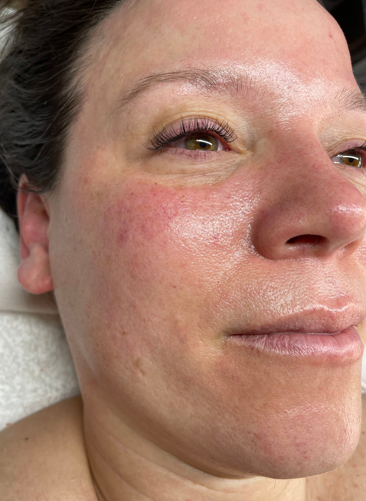 Client's skin after DMK Cellular Glow Therapy in Seattle